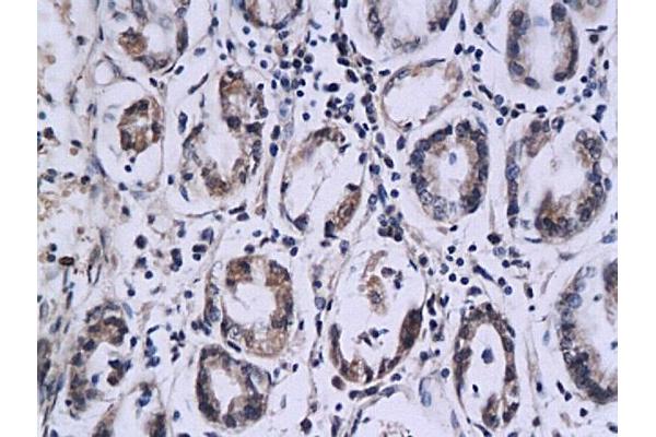 SPINK7/ECRG2 antibody  (AA 51-85)