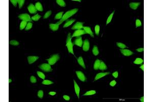 Immunofluorescence of purified MaxPab antibody to CUL1 on HeLa cell. (Cullin 1 antibody  (AA 1-776))