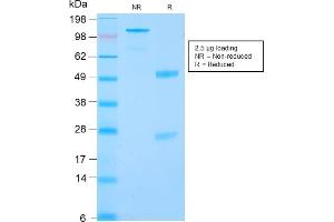 SDS-PAGE Analysis Purified RCC Rabbit Recombinant Monoclonal Antibody (CA9/2993R). (Recombinant CA9 antibody)