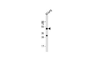 Anti-DPEP2 Antibody (Center) at 1:2000 dilution + mouse lung lysate Lysates/proteins at 20 μg per lane. (DPEP2 antibody  (AA 220-254))