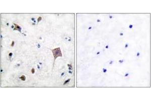 Immunohistochemistry analysis of paraffin-embedded human brain tissue, using PYK2 (Ab-580) Antibody. (PTK2B antibody  (AA 546-595))