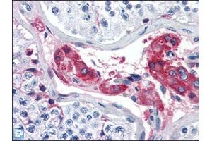Human Testis (formalin-fixed, paraffin-embedded) stained with F12at 5 µg/ml followed by biotinylated anti-goat IgG secondary antibody, alkaline phosphatase-streptavidin and chromogen. (F12 antibody)