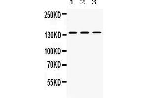 Western blot analysis of Nephrin expression in rat kidney extract ( Lane 1), mouse kidney extract ( Lane 2) and 293T whole cell lysates ( Lane 3).