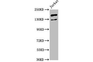 Western Blot Positive WB detected in: Jurkat whole cell lysate All lanes: CASZ1 antibody at 4. (CASZ1 antibody  (AA 127-266))