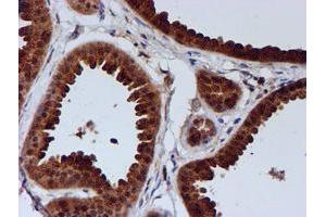 Immunohistochemical staining of paraffin-embedded Human breast tissue using anti-C1orf50 mouse monoclonal antibody.