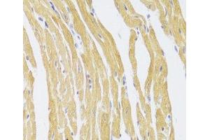 CSRP3 antibody