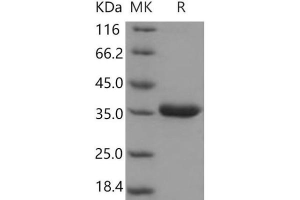 PRSS8 Protein (AA 30-289) (His tag)