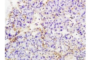 Formalin-fixed and paraffin embedded rat pancreas tissue labeled with Anti-MTUS1 Polyclonal Antibody, Unconjugated  at 1:200 followed by conjugation to the secondary antibody and DAB staining (MTUS1 antibody  (AA 1151-1270))