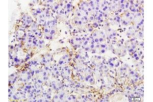 Formalin-fixed and paraffin embedded rat pancreas tissue labeled with Anti-MTUS1 Polyclonal Antibody, Unconjugated  at 1:200 followed by conjugation to the secondary antibody and DAB staining