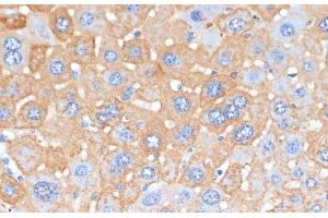 Immunohistochemistry of paraffin-embedded Mouse liver using APCS Polyclonal Antibody at dilution of 1:100 (40x lens). (APCS antibody)
