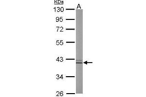 Liver Arginase antibody