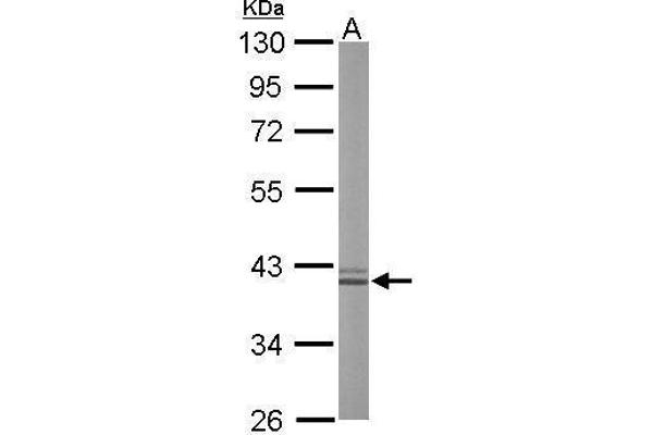 Liver Arginase antibody