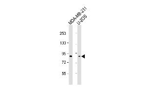 All lanes : Anti-SMURF2 Antibody at 1:2000-1:4000 dilution Lane 1: MDA-MB-231 whole cell lysate Lane 2: U-2OS whole cell lysate Lysates/proteins at 20 μg per lane. (SMURF2 antibody)