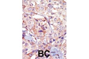 Immunohistochemistry (IHC) image for anti-Germ Cell Associated 2 (Haspin) (GSG2) antibody (ABIN3003656)
