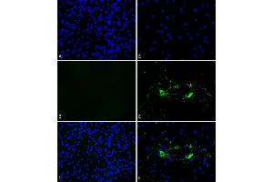 Primary rat hippocampal neurons show lewy body inclusion formation and loss of cells when treated with Type 1 mouse Alpha Synuclein Protein Pre-formed Fibrils (ABIN5651245, ABIN5651246 and ABIN5651247) at 4 μg/mL (D-F) on DVI2, but not when treated with a control (A-C). (SNCA Protein (full length))