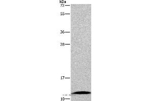Western blot analysis of Mouse small intestine tissue, using FABP6 Polyclonal Antibody at dilution of 1:550 (FABP6 antibody)
