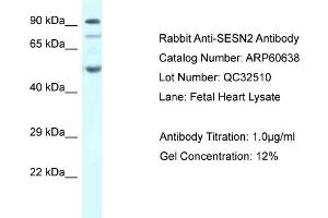Western Blotting (WB) image for anti-Sestrin 2 (SESN2) (C-Term) antibody (ABIN786225) (Sestrin 2 antibody  (C-Term))