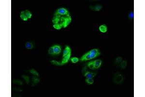 Immunofluorescence staining of HepG2 with ABIN7170757 at 1:33, counter-stained with DAPI. (CYP21A2 antibody  (AA 312-418))