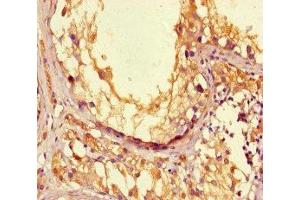 Immunohistochemistry of paraffin-embedded human testis tissue using ABIN7166656 at dilution of 1:100 (LPAL2 antibody  (AA 52-124))