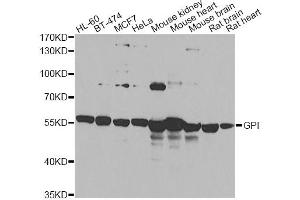 Western blot analysis of extracts of various cell lines, using GPI antibody (ABIN6292114) at 1:1000 dilution.