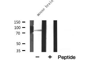 Western blot analysis of extracts from mouse brain, using MARK3 antibody. (MARK3 antibody  (N-Term))
