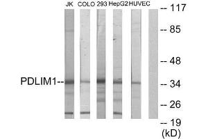 Western Blotting (WB) image for anti-PDZ and LIM Domain 1 (PDLIM1) (Internal Region) antibody (ABIN1848910) (PDLIM1 antibody  (Internal Region))