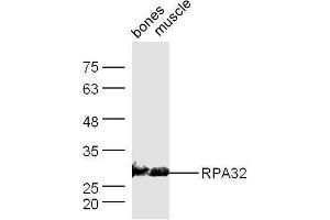 Mouse bone/muscle lysates 30ug, probed with Anti-RPA32 Polyclonal Antibody  at 1:5000 90min in 37˚C. (RPA2 antibody  (AA 101-200))