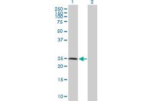 Western Blot analysis of RNF114 expression in transfected 293T cell line by RNF114 MaxPab polyclonal antibody. (RNF114 antibody  (AA 1-228))