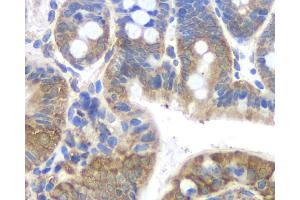Immunohistochemistry analysis of paraffin-embedded mouse colon using FAS Monoclonal Antibody at dilution of 1:200. (FAS antibody)