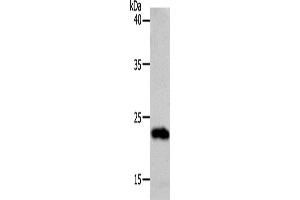 Western Blotting (WB) image for anti-Suppressor of Cytokine Signaling 1 (SOCS1) antibody (ABIN2426413) (SOCS1 antibody)