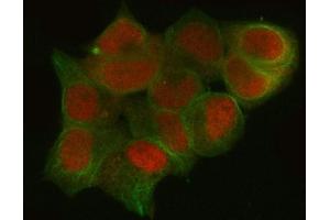 IF analysis of CTBP1 using anti-CTBP1 antibody (ABIN3043816) and anti-Tubulin Alpha antibody (ABIN7600339).