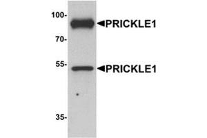 Western blot analysis of PRICKLE1 in human bladder tissue lysate with PRICKLE1 antibody at 1 ug/mL.