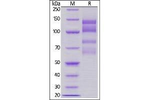 Human ITGA4&ITGB1 Heterodimer Protein, His Tag&Tag Free on  under reducing (R) condition.