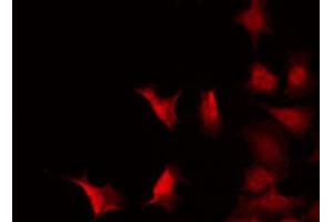 ABIN6267272 staining 293 by IF/ICC. (c-MYC antibody  (pThr58))