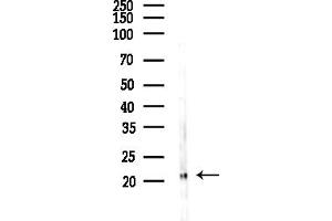 Western blot analysis of lysates from COLO205 cells(UV,30 min treatment), using GPX4 Antibody at 1/1000 dilution.
