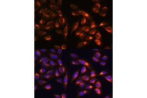 Immunofluorescence analysis of U-2 OS cells using PTCD1 antibody (ABIN7269203) at dilution of 1:100. (PTCD1 antibody  (AA 435-537))