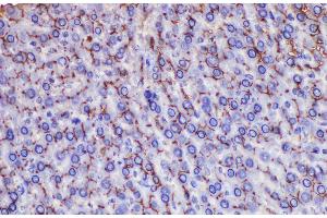 Immunohistochemistry of paraffin-embedded Rat liver using Ceacam1 Polycloanl Antibody at dilution of 1:200 (CEACAM1 antibody)