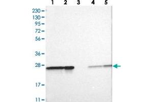 Western blot analysis of Lane 1: RT-4, Lane 2: U-251 MG, Lane 3: Human Plasma, Lane 4: Liver, Lane 5: Tonsil with PSMA2 polyclonal antibody .
