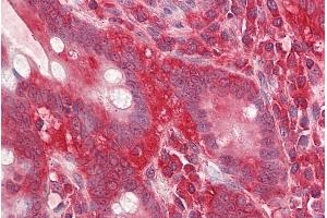Immunohistochemistry (IHC) image for anti-Guanine Nucleotide Binding Protein (G Protein), beta Polypeptide 2-Like 1 (GNB2L1) (Internal Region) antibody (ABIN768551)