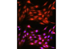 Immunofluorescence analysis of C6 cells using VCP Rabbit mAb (ABIN7271284) at dilution of 1:100 (40x lens). (VCP antibody)