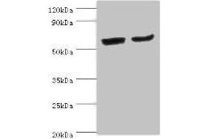 Western blot All lanes: CYP2J2 antibody at 4 μg/mL Lane 1: Mouse skeletal muscle tissue Lane 2: Rat liver tissue Secondary Goat polyclonal to rabbit IgG at 1/10000 dilution Predicted band size: 58 kDa Observed band size: 58 kDa (CYP2J2 antibody  (AA 328-502))