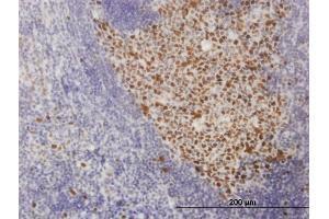 Immunoperoxidase of monoclonal antibody to SOX9 on formalin-fixed paraffin-embedded human tonsil. (SOX9 antibody  (AA 400-509))