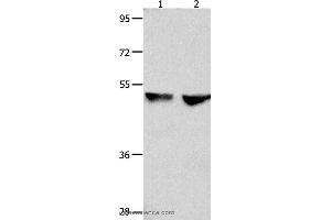 Western blot analysis of 823 and Hela cell , using CDK9 Polyclonal Antibody at dilution of 1:300 (CDK9 antibody)
