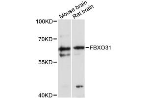 Western blot analysis of extracts of various cell lines, using FBXO31 antibody (ABIN6291619) at 1:3000 dilution. (FBXO31 antibody)