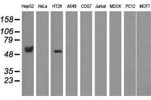 Western blot analysis of extracts (35 µg) from 9 different cell lines by using anti-CORO1B monoclonal antibody. (CORO1B antibody)