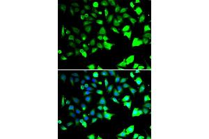 Immunofluorescence analysis of HeLa cells using XIAP antibody (ABIN6130929, ABIN6150289, ABIN6150292 and ABIN6217214). (XIAP antibody  (AA 1-200))