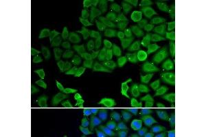 Immunofluorescence analysis of A549 cells using VPS4A Polyclonal Antibody (VPS4A antibody)