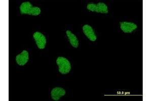 Immunofluorescence of monoclonal antibody to PPARBP on HeLa cell. (MED1 antibody  (AA 1391-1490))