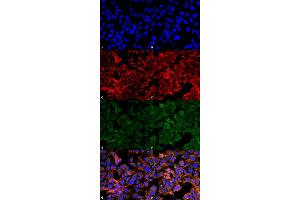 Immunocytochemistry/Immunofluorescence analysis using Mouse Anti-Malondialdehyde Monoclonal Antibody, Clone 11E3 . (Malondialdehyde antibody  (Atto 390))