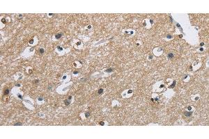 Immunohistochemistry of paraffin-embedded Human brain using CAB39L Polyclonal Antibody at dilution of 1:40 (CAB39L antibody)